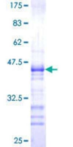 Novus Biologicals Recombinant Human WBP1 GST (N-Term) Protein 25 &mu;g | Buy Online | Novus Biologicals&trade; | Fisher Scientific