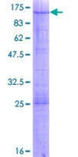 Novus Biologicals Recombinant Human GTPBP4 GST (N-Term) Protein 2 &mu;g | Buy Online | Novus Biologicals&trade; | Fisher Scientific