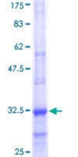 Novus Biologicals Recombinant Human Claudin-14 GST (N-Term) Protein 10 &mu;g | Buy Online | Novus Biologicals&trade; | Fisher Scientific
