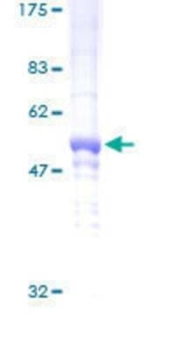 Novus Biologicals Recombinant Human DDAH2 GST (N-Term) Protein 2 &mu;g | Buy Online | Novus Biologicals&trade; | Fisher Scientific
