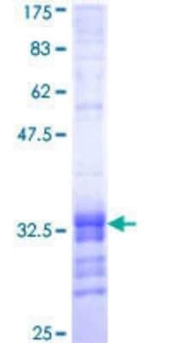 Novus Biologicals Recombinant Human CDC42EP4 GST (N-Term) Protein 10 &mu;g | Buy Online | Novus Biologicals&trade; | Fisher Scientific