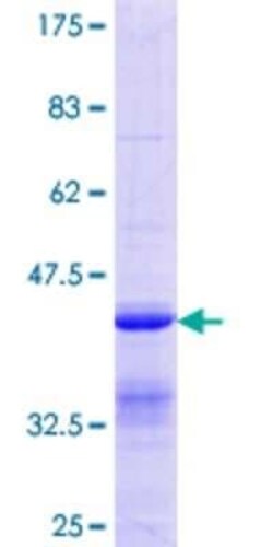 Novus Biologicals Recombinant Human CCNDBP1 GST (N-Term) Protein 10 &mu;g | Buy Online | Novus Biologicals&trade; | Fisher Scientific
