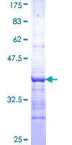 Novus Biologicals Recombinant Human APR-2 GST (N-Term) Protein 25 &mu;g | Buy Online | Novus Biologicals&trade; | Fisher Scientific