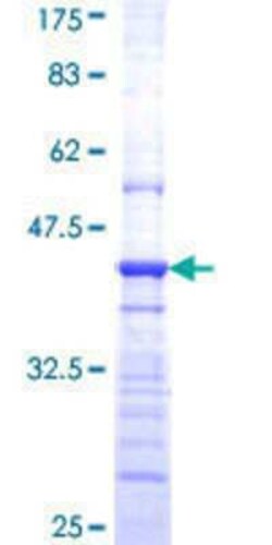 Novus Biologicals Recombinant Human HEBP2 GST (N-Term) Protein 10 &mu;g | Buy Online | Novus Biologicals&trade; | Fisher Scientific