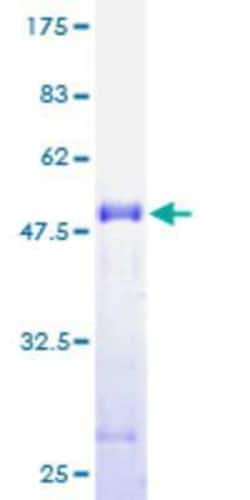 Novus Biologicals Recombinant Human CGI-16 GST (N-Term) Protein 10 &mu;g | Buy Online | Novus Biologicals&trade; | Fisher Scientific
