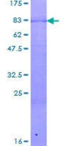 Novus Biologicals Recombinant Human PATZ GST (N-Term) Protein 2 &mu;g | Buy Online | Novus Biologicals&trade; | Fisher Scientific