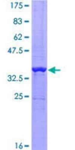 Novus Biologicals Recombinant Human PATZ GST (N-Term) Protein 10 &mu;g | Buy Online | Novus Biologicals&trade; | Fisher Scientific