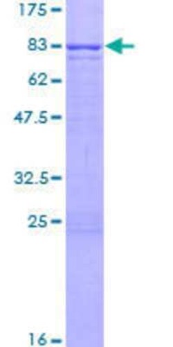 Novus Biologicals Recombinant Human Coronin 3 GST (N-Term) Protein 2 &mu;g | Buy Online | Novus Biologicals&trade; | Fisher Scientific