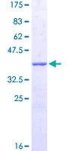 Novus Biologicals Recombinant Human Coronin 3 GST (N-Term) Protein 25 &mu;g | Buy Online | Novus Biologicals&trade; | Fisher Scientific