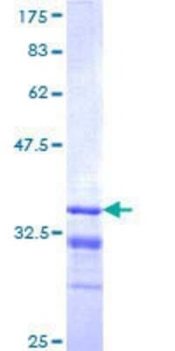 Novus Biologicals Recombinant Human MKRN1 GST (N-Term) Protein 10 &mu;g | Buy Online | Novus Biologicals&trade; | Fisher Scientific