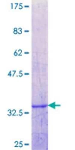 Novus Biologicals Recombinant Human PHLDA3 GST (N-Term) Protein 25 &mu;g | Buy Online | Novus Biologicals&trade; | Fisher Scientific