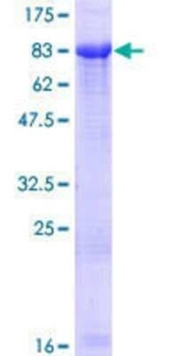 Novus Biologicals Recombinant Human ZIM2 GST (N-Term) Protein 25 &mu;g | Buy Online | Novus Biologicals&trade; | Fisher Scientific