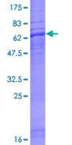 Novus Biologicals Recombinant Human NTS2/NTSR2 GST (N-Term) Protein 25 &mu;g | Buy Online | Novus Biologicals&trade; | Fisher Scientific