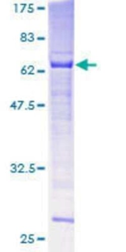 Novus Biologicals Recombinant Human SPO11 GST (N-Term) Protein 10 &mu;g | Buy Online | Novus Biologicals&trade; | Fisher Scientific