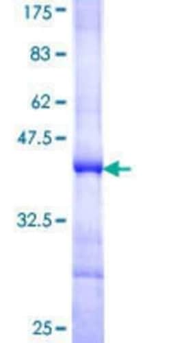 Novus Biologicals Recombinant Human SPO11 GST (N-Term) Protein 10 &mu;g | Buy Online | Novus Biologicals&trade; | Fisher Scientific