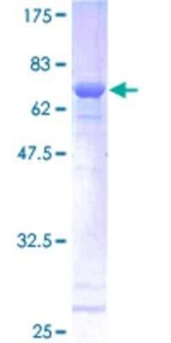 Novus Biologicals Recombinant Human SSBP2 GST (N-Term) Protein 25 &mu;g | Buy Online | Novus Biologicals&trade; | Fisher Scientific