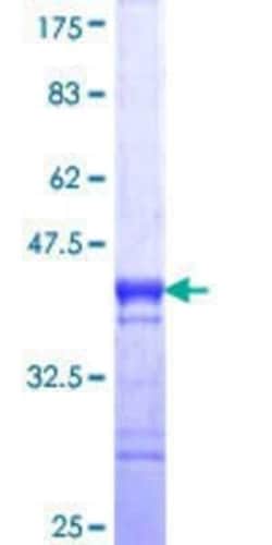 Novus Biologicals Recombinant Human NUP62 GST (N-Term) Protein 25 &mu;g | Buy Online | Novus Biologicals&trade; | Fisher Scientific