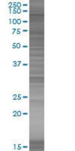 Novus Biologicals RABGAP1 293T Cell Transient Overexpression Lysate 0.1 mL | Buy Online | Novus Biologicals&trade; | Fisher Scientific