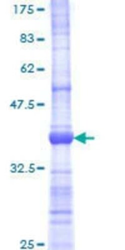 Novus Biologicals Recombinant Human LDOC1 GST (N-Term) Protein 25 &mu;g | Buy Online | Novus Biologicals&trade; | Fisher Scientific