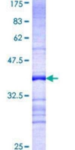 Novus Biologicals Recombinant Human GADD34 GST (N-Term) Protein 25 &mu;g | Buy Online | Novus Biologicals&trade; | Fisher Scientific