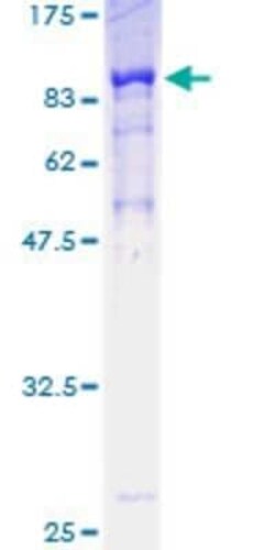 Novus Biologicals Recombinant Human POLA2 GST (N-Term) Protein 25 &mu;g | Buy Online | Novus Biologicals&trade; | Fisher Scientific