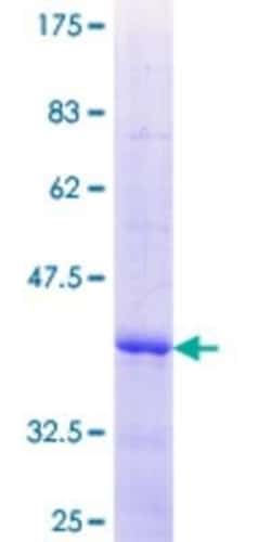 Novus Biologicals Recombinant Human TRIM29 GST (N-Term) Protein 25 &mu;g | Buy Online | Novus Biologicals&trade; | Fisher Scientific