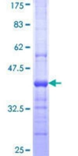 Novus Biologicals Recombinant Human LYPLA3 GST (N-Term) Protein 10 &mu;g | Buy Online | Novus Biologicals&trade; | Fisher Scientific