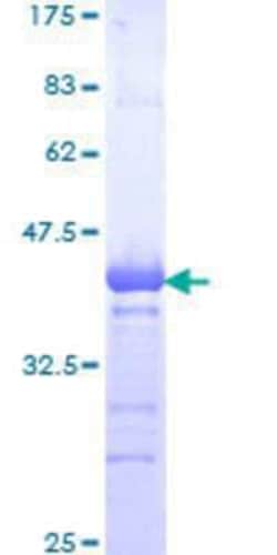 Novus Biologicals Recombinant Human ZFP95 GST (N-Term) Protein 25 &mu;g | Buy Online | Novus Biologicals&trade; | Fisher Scientific