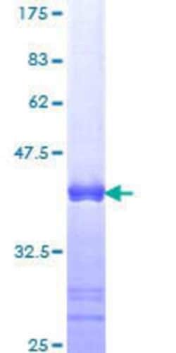 Novus Biologicals Recombinant Human SH3BP4 GST (N-Term) Protein 10 &mu;g | Buy Online | Novus Biologicals&trade; | Fisher Scientific