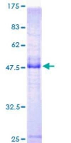 Novus Biologicals Recombinant Human MiRP3 GST (N-Term) Protein 10 &mu;g | Buy Online | Novus Biologicals&trade; | Fisher Scientific