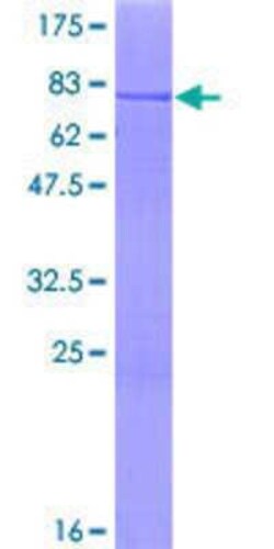 Novus Biologicals Recombinant Human CARKL GST (N-Term) Protein 10 &mu;g | Buy Online | Novus Biologicals&trade; | Fisher Scientific