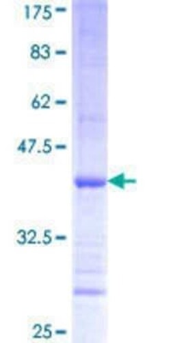 Novus Biologicals Recombinant Human PISD GST (N-Term) Protein 10 &mu;g | Buy Online | Novus Biologicals&trade; | Fisher Scientific