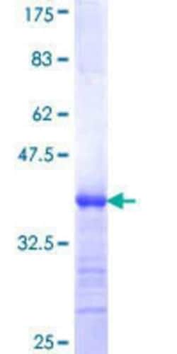 Novus Biologicals Recombinant Human POTEH GST (N-Term) Protein 10 &mu;g | Buy Online | Novus Biologicals&trade; | Fisher Scientific