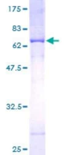Novus Biologicals Recombinant Human MTCH1 GST (N-Term) Protein 25 &mu;g | Buy Online | Novus Biologicals&trade; | Fisher Scientific