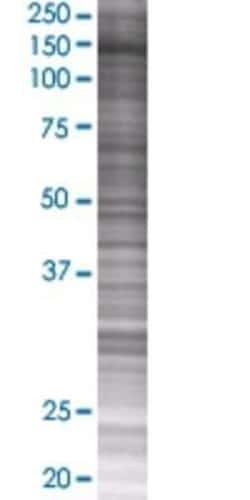 Novus Biologicals Kif4A 293T Cell Transient Overexpression Lysate 0.1 mL | Buy Online | Novus Biologicals&trade; | Fisher Scientific