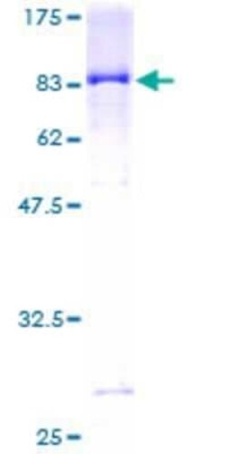 Novus Biologicals Recombinant Human IFIT5 GST (N-Term) Protein 25 &mu;g | Buy Online | Novus Biologicals&trade; | Fisher Scientific