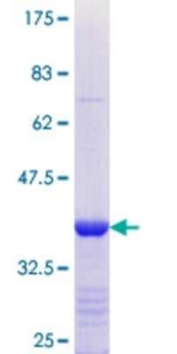 Novus Biologicals Recombinant Human Pannexin-1 GST (N-Term) Protein 10 &mu;g | Buy Online | Novus Biologicals&trade; | Fisher Scientific
