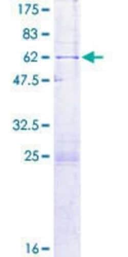 Novus Biologicals Recombinant Human HS747E2A GST (N-Term) Protein 2 &mu;g | Buy Online | Novus Biologicals&trade; | Fisher Scientific