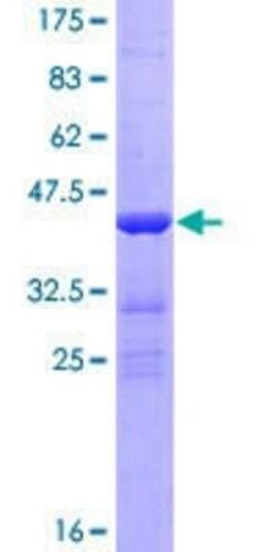 Novus Biologicals Recombinant Human PGEA1 GST (N-Term) Protein 25 &mu;g | Buy Online | Novus Biologicals&trade; | Fisher Scientific