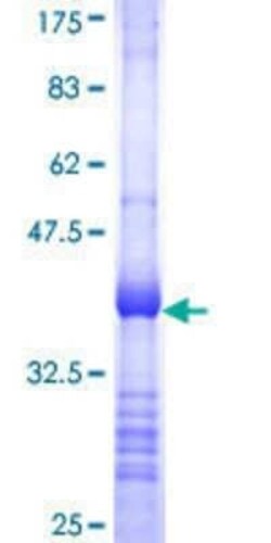 Novus Biologicals Recombinant Human PGEA1 GST (N-Term) Protein 25 &mu;g | Buy Online | Novus Biologicals&trade; | Fisher Scientific