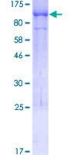 Novus Biologicals Recombinant Human UNC84B GST (N-Term) Protein 25 &mu;g | Buy Online | Novus Biologicals&trade; | Fisher Scientific