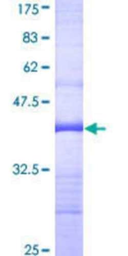 Novus Biologicals Recombinant Human RIPK5 GST (N-Term) Protein 10 &mu;g | Buy Online | Novus Biologicals&trade; | Fisher Scientific