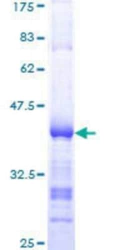 Novus Biologicals Recombinant Human RASGRP3 GST (N-Term) Protein 25 &mu;g | Buy Online | Novus Biologicals&trade; | Fisher Scientific