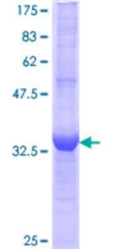 Novus Biologicals Recombinant Human RASGRP3 GST (N-Term) Protein 10 &mu;g | Buy Online | Novus Biologicals&trade; | Fisher Scientific