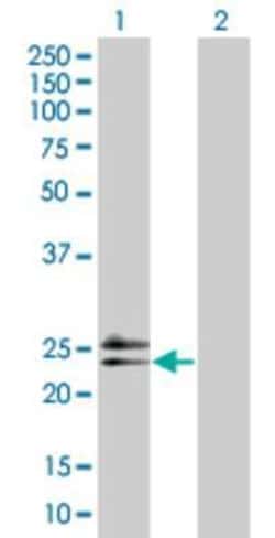 Novus Biologicals&trade;&nbsp;RAD54B 293T Cell Transient Overexpression Lysate