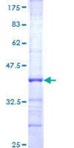 Novus Biologicals Recombinant Human FBXO7 GST (N-Term) Protein 10 &mu;g | Buy Online | Novus Biologicals&trade; | Fisher Scientific
