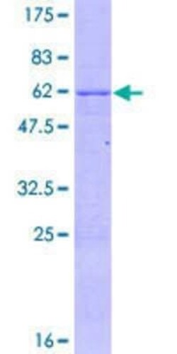 Novus Biologicals Recombinant Human ZNF324 GST (N-Term) Protein 10 &mu;g | Buy Online | Novus Biologicals&trade; | Fisher Scientific