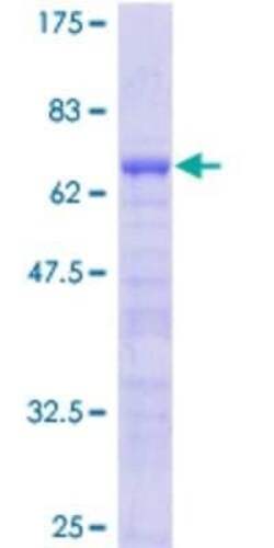 Novus Biologicals Recombinant Human LMOD1 GST (N-Term) Protein 25 &mu;g | Buy Online | Novus Biologicals&trade; | Fisher Scientific