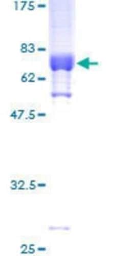 Novus Biologicals Recombinant Human SPDEF GST (N-Term) Protein 25 &mu;g | Buy Online | Novus Biologicals&trade; | Fisher Scientific