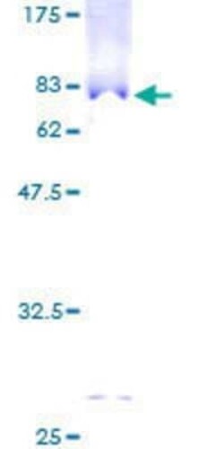 Novus Biologicals Recombinant Human TTLL1 GST (N-Term) Protein 2 &mu;g | Buy Online | Novus Biologicals&trade; | Fisher Scientific